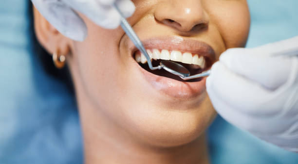 Best Emergency Dental Care for Broken or Chipped Teeth in Sunrise Manor, NV