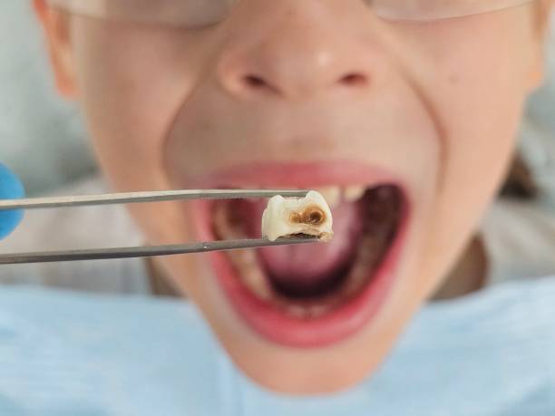 Best Urgent Care for Lost Fillings or Crowns in Sunrise Manor, NV